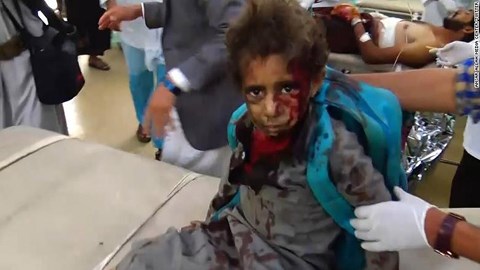 Hàng%20chục%20trẻ%20em%20Yemen%20thiệt%20mạng%20sau%20khi%20trúng%20tên%20lửa%20Ả%20Rập%20Xê%20út.jpg